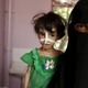 A woman holds her malnourished daughter at a hospital in Yemen’s capital Sanaa July 28, 2015. (Reuters/Khaled Abdullah)